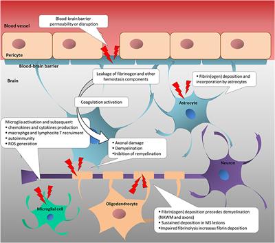 Coagulation Pathways in Neurological Diseases: Multiple Sclerosis